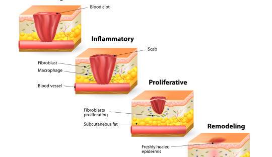 剖宫产怀孕后伤口刺痛怎么办,孕妇剖腹产后浑身发痒咋回事