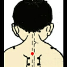 孩子发烧怎么办小儿推拿,孩子发烧怎么小儿推拿