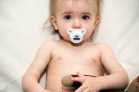 湿寒体质的孩子怎么调理,湿寒小孩子的表现