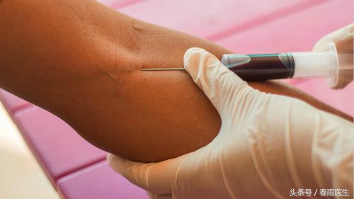 抽血时针眼处冒血怎么回事,抽血的针眼感觉刺痛