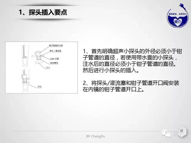 内镜超声小探头设定、使用、维护要点分析