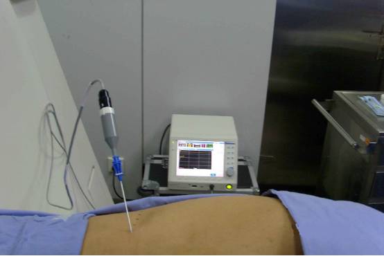 带状疱疹得过一次是否会终身免疫,带状疱疹是一次就终身免疫的吗