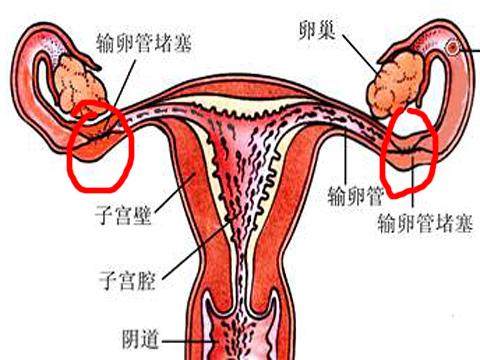 女性不孕全部项目要检查哪些,女性不孕不育七项检查是哪些