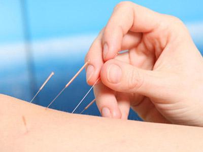 针灸怎样治疗高脂血症？