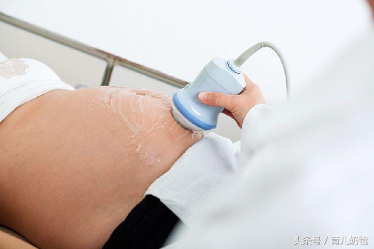 怀孕后做几次b超,怀孕期间大概需要做多少次b超