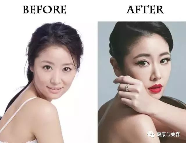 杨幂、唐嫣、神仙姐姐的鼻子原来是这样“整的”！