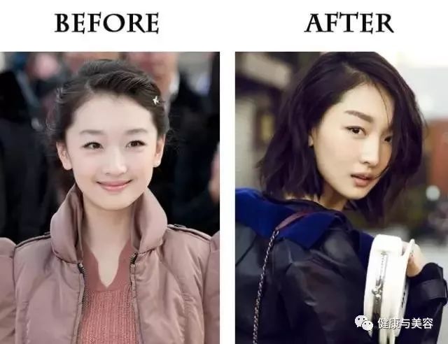 杨幂、唐嫣、神仙姐姐的鼻子原来是这样“整的”！