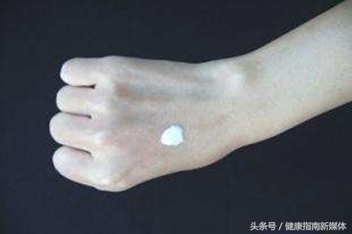 对称性神经性皮炎治疗,治疗神经性皮炎的软膏