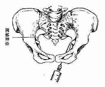 顺产也要挨一刀是真的吗,顺产为什么风险大
