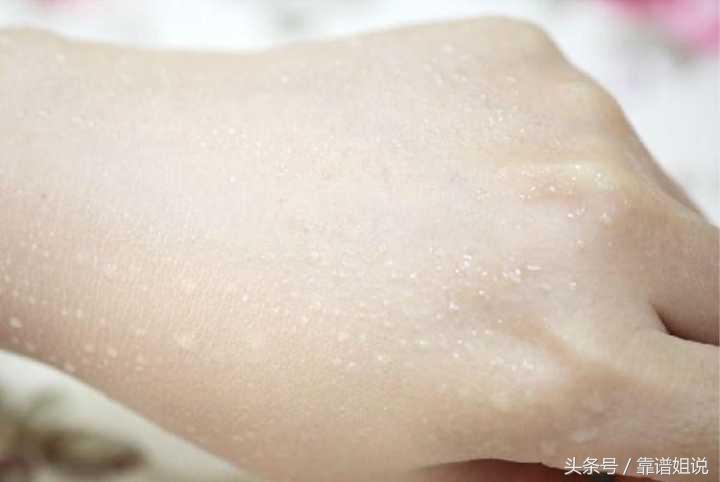 补水BB霜修复,bb霜局部