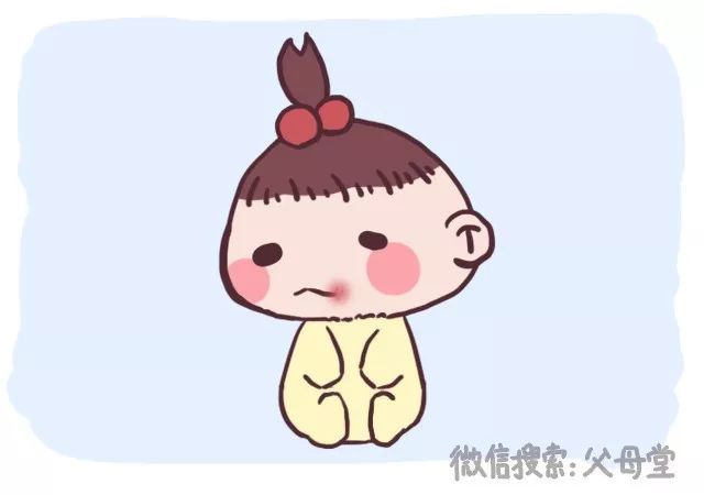 小孩上火有黄鼻涕和眼屎怎么办,宝宝流鼻血有眼屎是上火吗