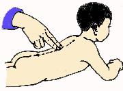 小儿推拿风寒感冒推拿处方,小儿推拿治疗风寒感冒