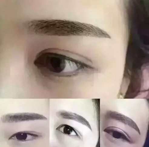 美甲店做微整形违法吗,美甲店做微整