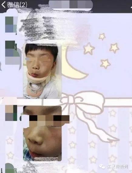 湖北大学生家暴女生,湖北一女大学生被家暴