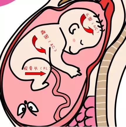 教你读懂产检b超单上英文缩写,如何看懂16周产检b超