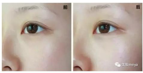 一只眼睛变大一只眼睛小怎么办,如何让眼睛变大变好看小技巧