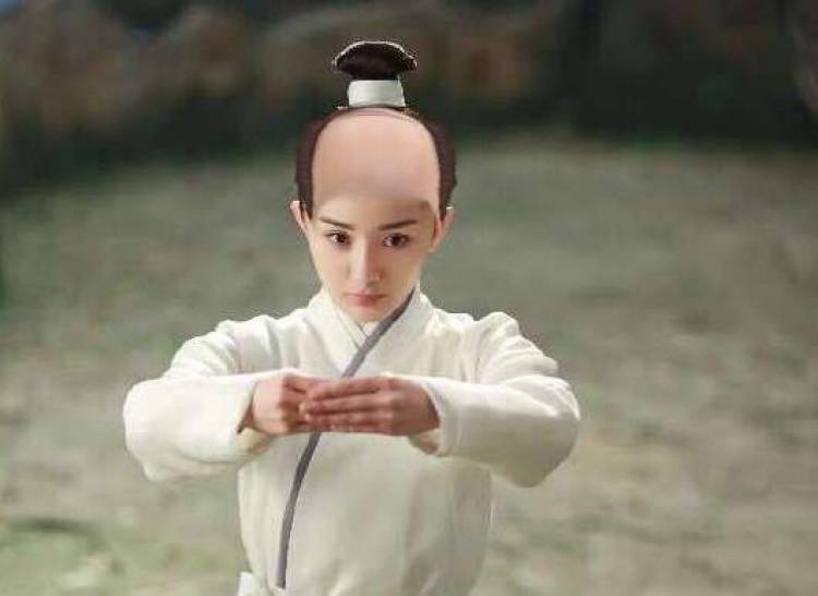 产后发际线后移怎么办,产后脱发发际线脱得最厉害