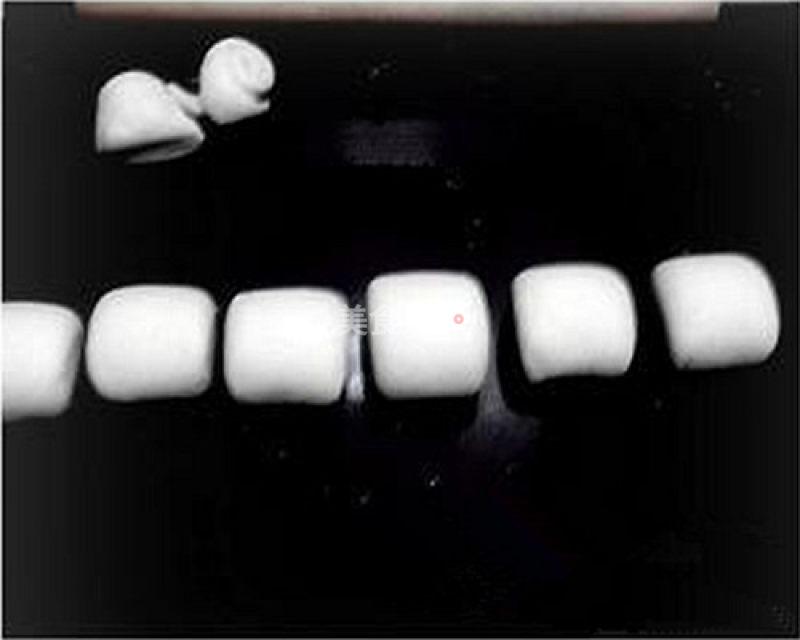 用老面发酵蒸的馒头发酸怎么办,老面蒸馒头不用碱会酸吗