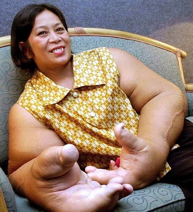 这么大的器官如何长的，全都打破吉尼斯记录，看到第一个我服了