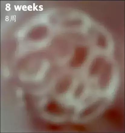 幼儿视力用视力表检查准确步骤,幼儿园孩子视力检测表准确吗