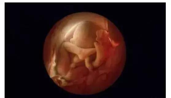 堕胎后有什么明显反应,堕胎后怎么挽救