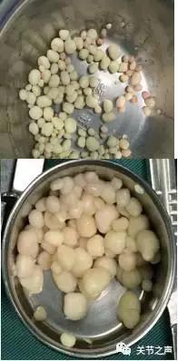 关节腔里长珍珠,关节附近长珍珠