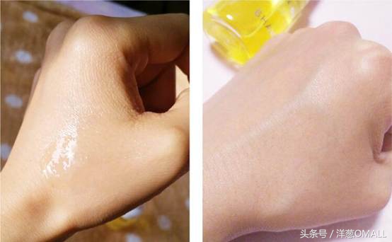 痘痘肌敏感肌混油皮区别,痘痘肌混油皮的面霜推荐