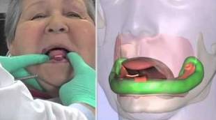 缺牙会引起口腔问题,缺牙怎么治疗不影响做核磁