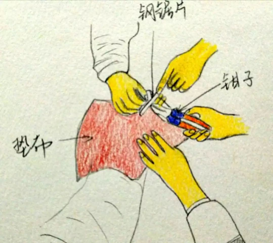 不会“摘除”戒指的帅蜀黍不是好消防员！