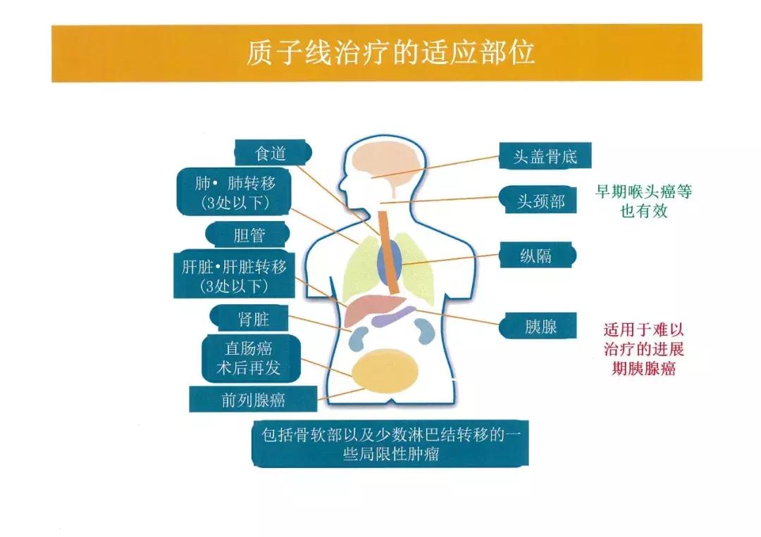 质子放疗中心安全距离,质子放疗介绍费