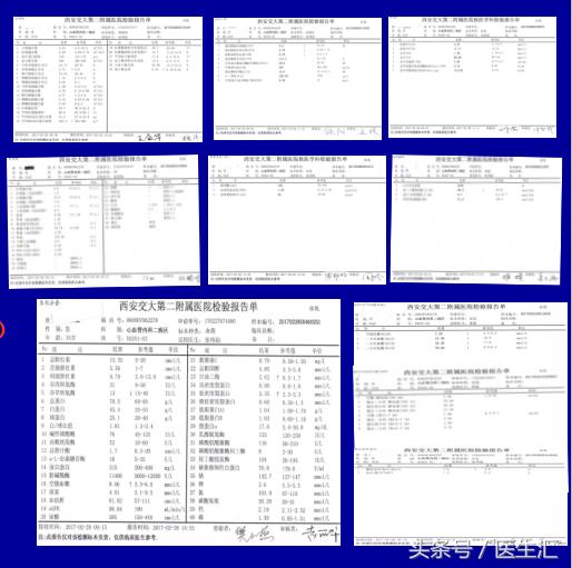 年轻高血压患者的降压方案,青年高血压要怎么吃降压药