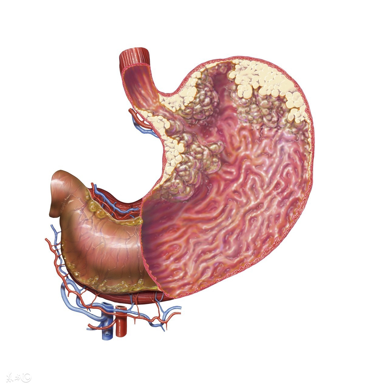 专家支招常见肠胃问题该怎么办,肠胃不舒服医生检查视频
