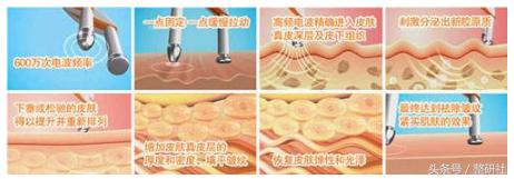 温顺谦和大妈修炼计——扼制颈部老化