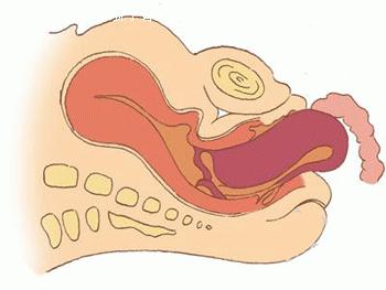孕妇大肚子在水中分娩过程,中国孕妇在水中分娩过程