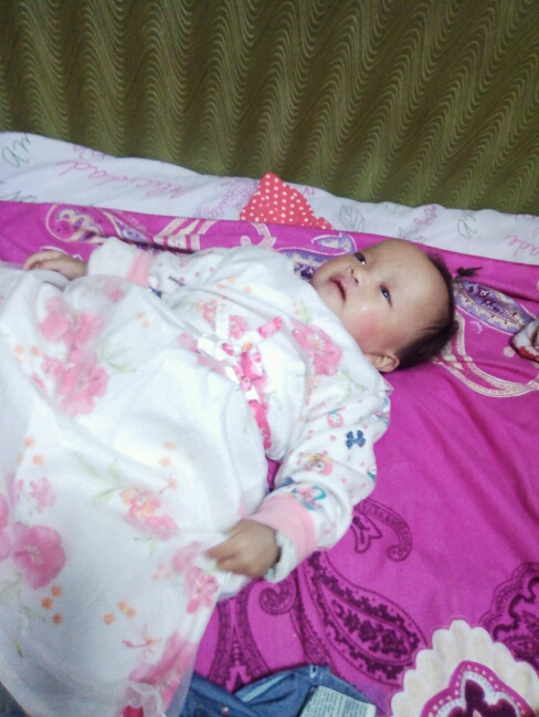 婴儿单纯先天裂唇7毫米,先天性腭裂是什么