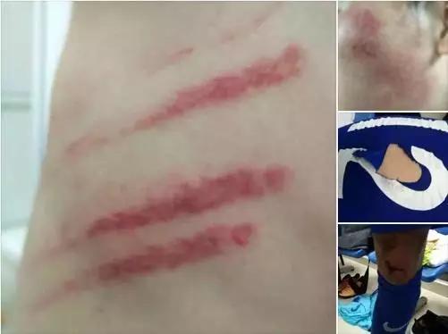 江苏苏宁被打,江苏苏宁球员最新消息