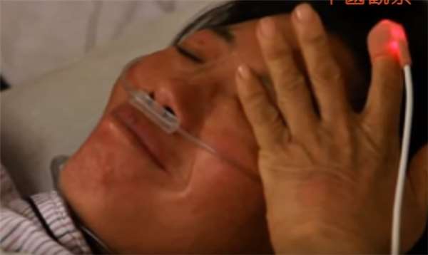 男婴先天无肛怎么排便,出生无法排便的罕见病宝宝