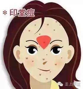 脸上长痘痘可以用醋洗脸吗,用醋洗面会长痘