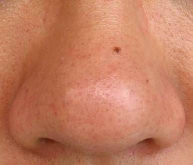 黑头鼻贴的正确贴法图,rnw黑头贴正确用法