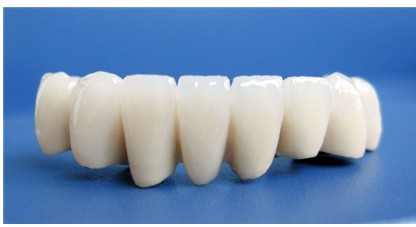 镶牙有几种瓷质材料,镶牙用什么材料粘的