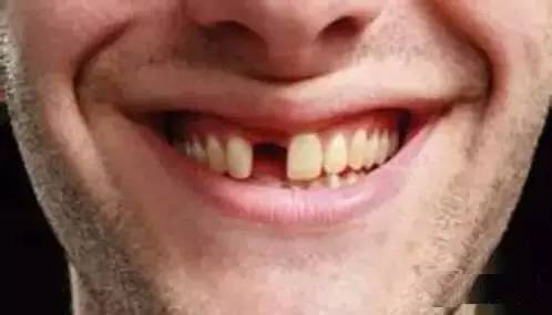 掉牙以后不管，后果竟然这么严重
