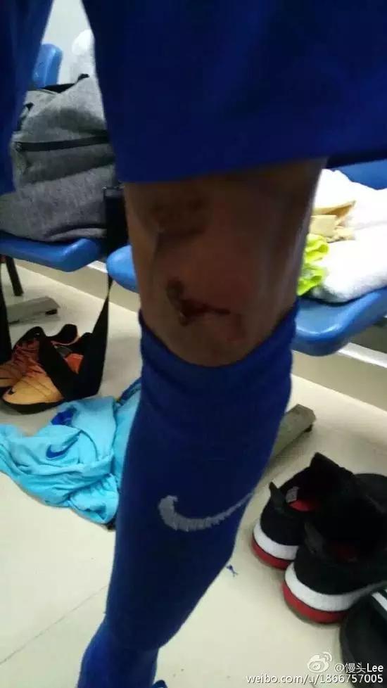 江苏苏宁被打,江苏苏宁球员最新消息