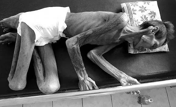 用套套挽救770万人生命！这个75岁泰国老头做到了！