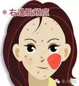 脸上长痘痘可以用醋洗脸吗,用醋洗面会长痘