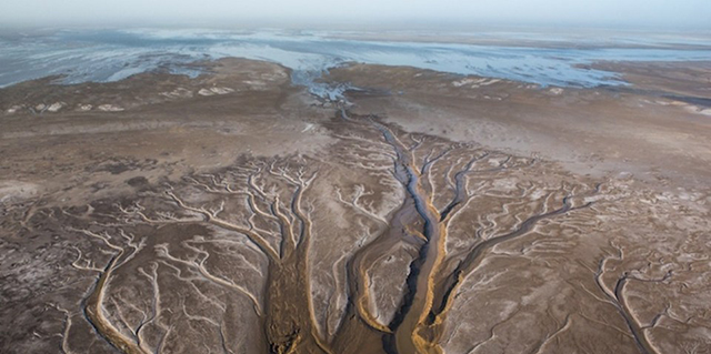 瘦人能做自体脂肪丰胸吗,太瘦了为什么不能做手术