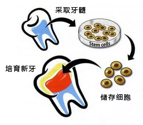 牙齿缺损能通过种植牙解决吗,牙齿缺损可以直接拔掉吗