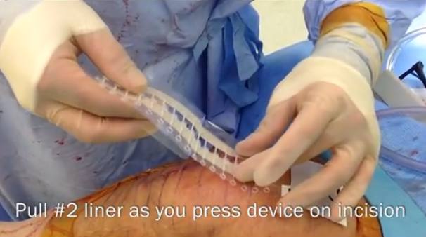 婊存按涔嬪,婊存按涔嬪鍜嬫牱