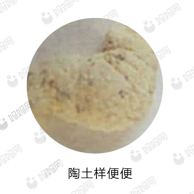 宝宝拉这几种便便要去医院,宝宝有问题的便便是怎样的