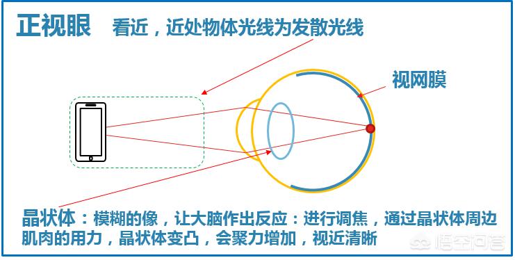 晚上如何远眺防近视,为什么远眺有助于预防近视