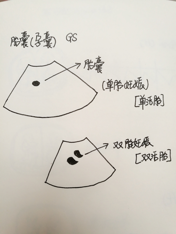 看清宫表生娃准吗,清宫表测试到底准不准